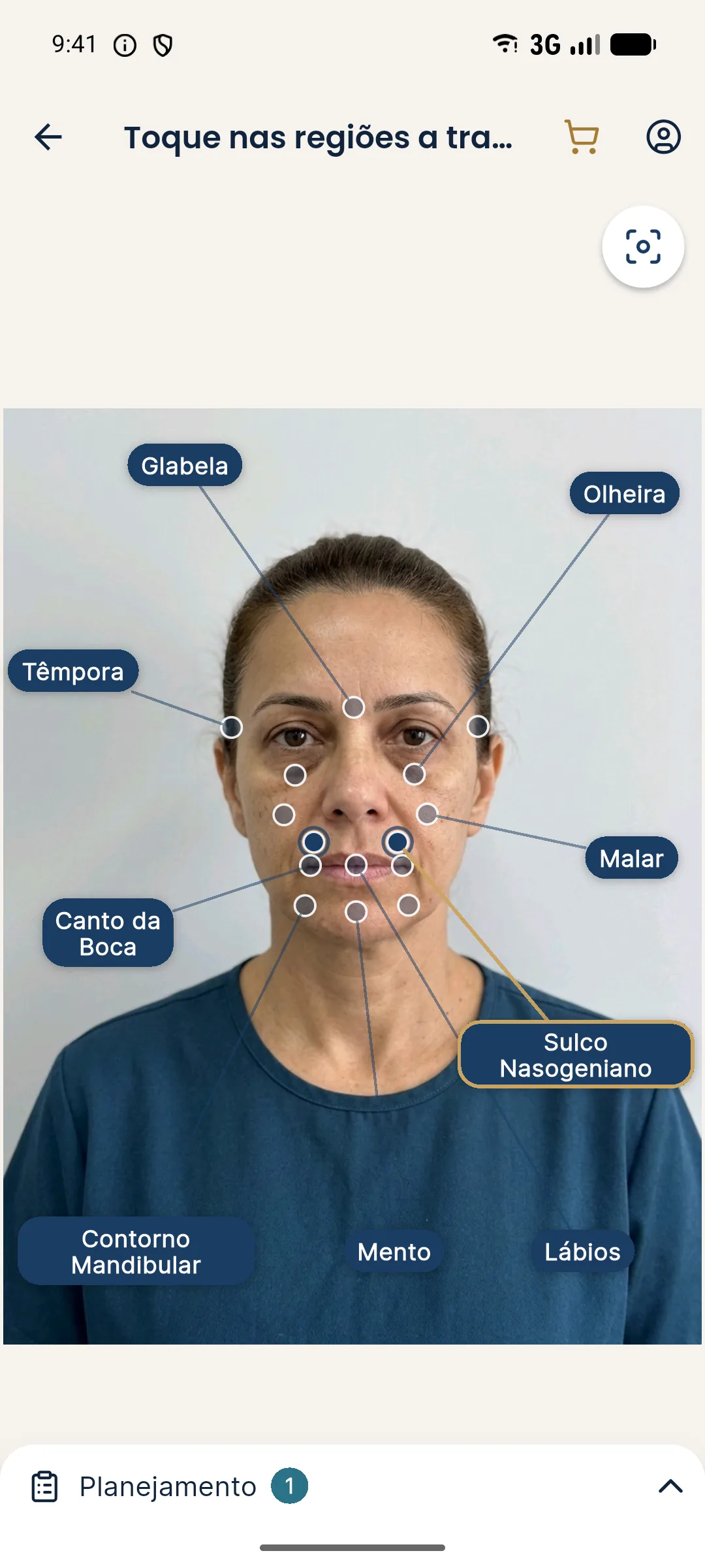 Tela de marcação do Harmy com o ponto Sulco Nasogeniano selecionado sobre a foto da pessoa fictícia