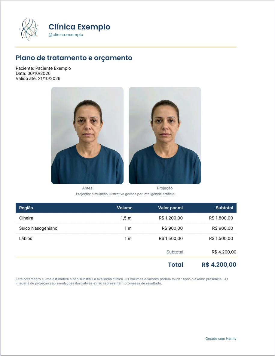 Folha do orçamento em PDF do Harmy com cabeçalho Clínica Exemplo, fotos Antes e Projeção, tabela de regiões e total de R$ 4.200,00