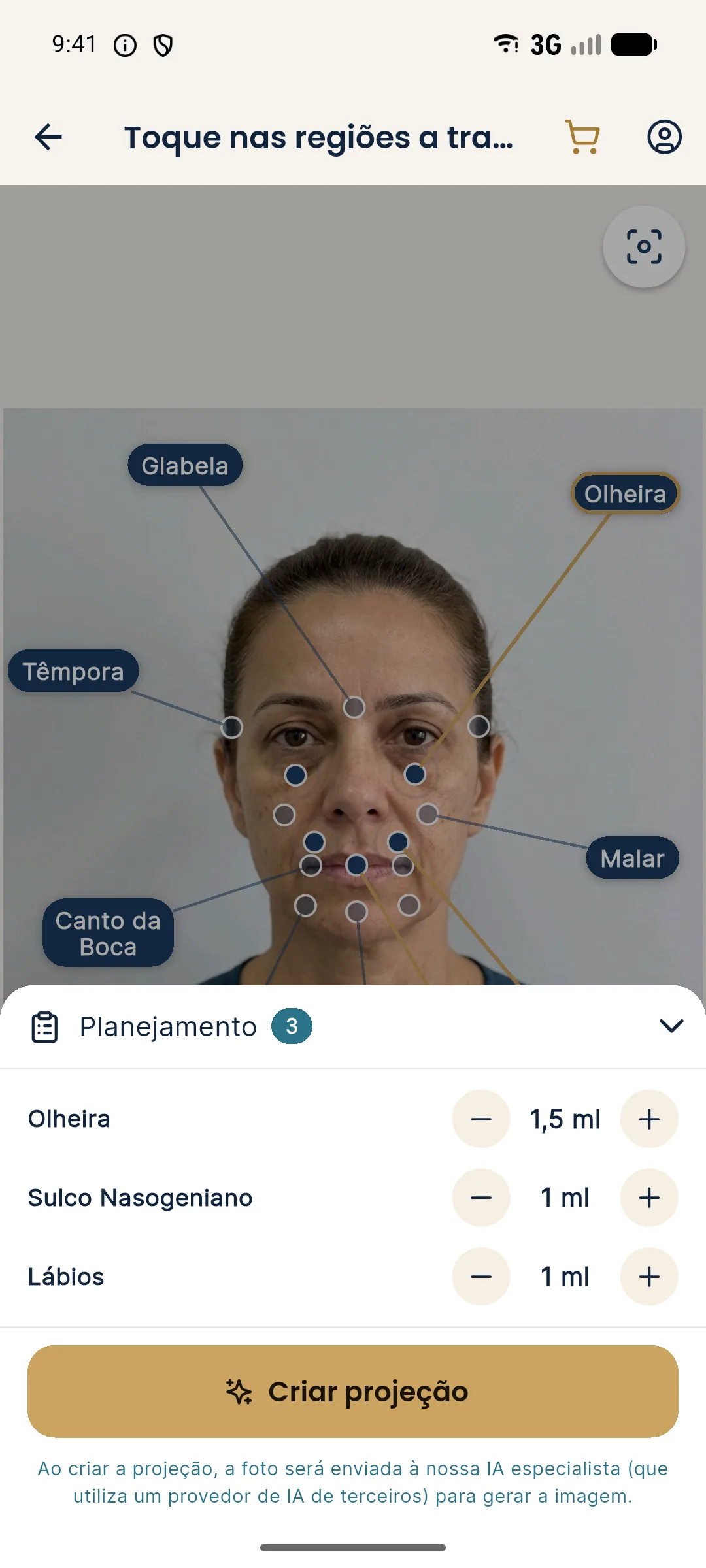 Planejamento do Harmy com Olheira em 1,5 ml, Sulco Nasogeniano em 1 ml, Lábios em 1 ml e o botão Criar projeção