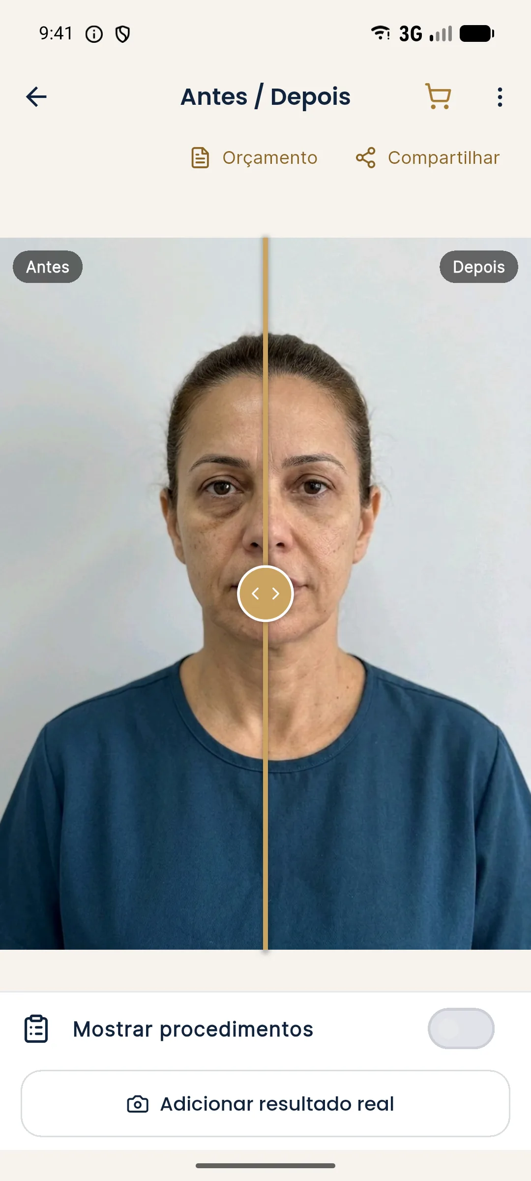 Tela Antes e Depois aberta pelo Histórico do Harmy, com o botão Adicionar resultado real no rodapé